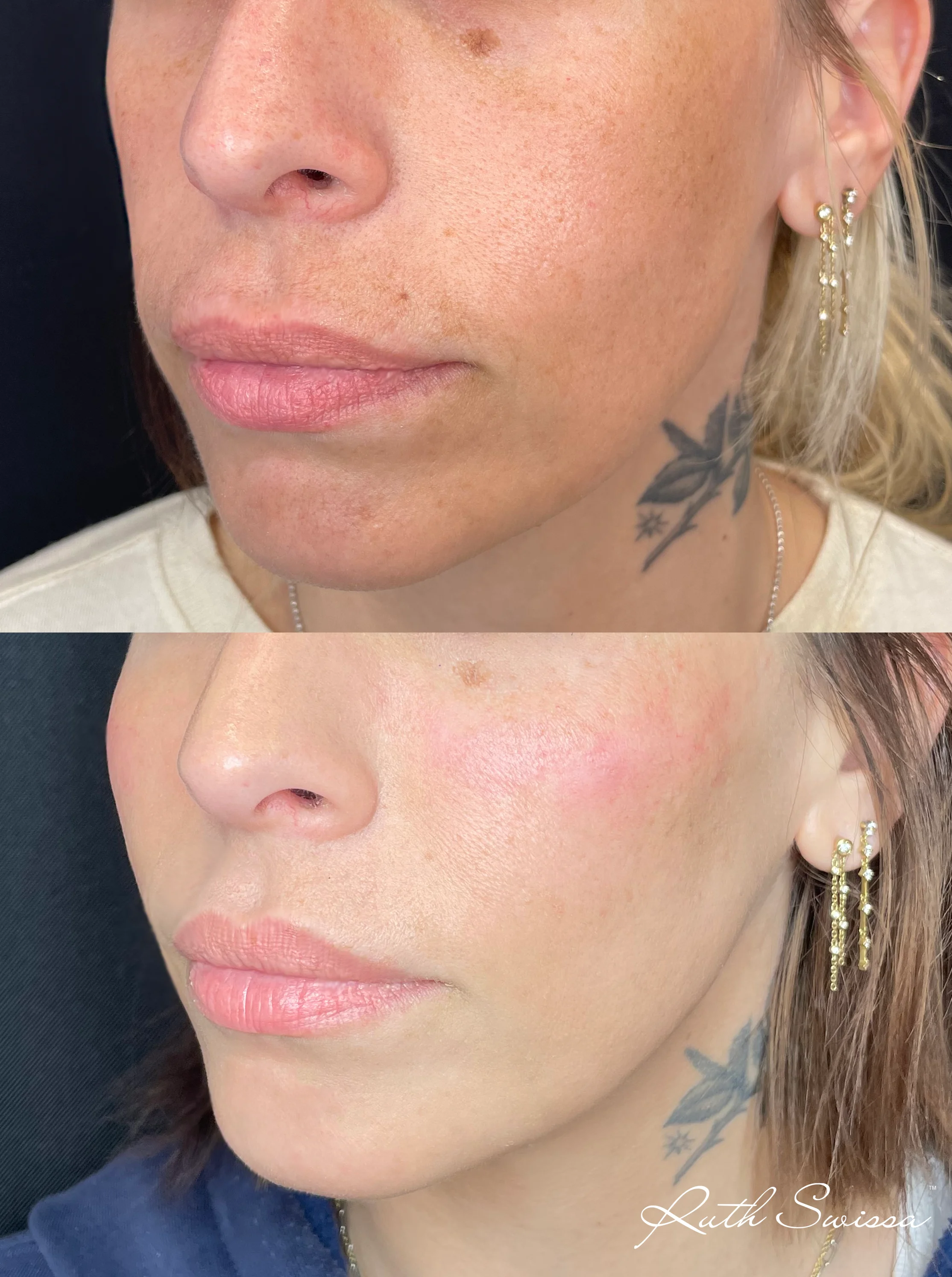 Facial balancing