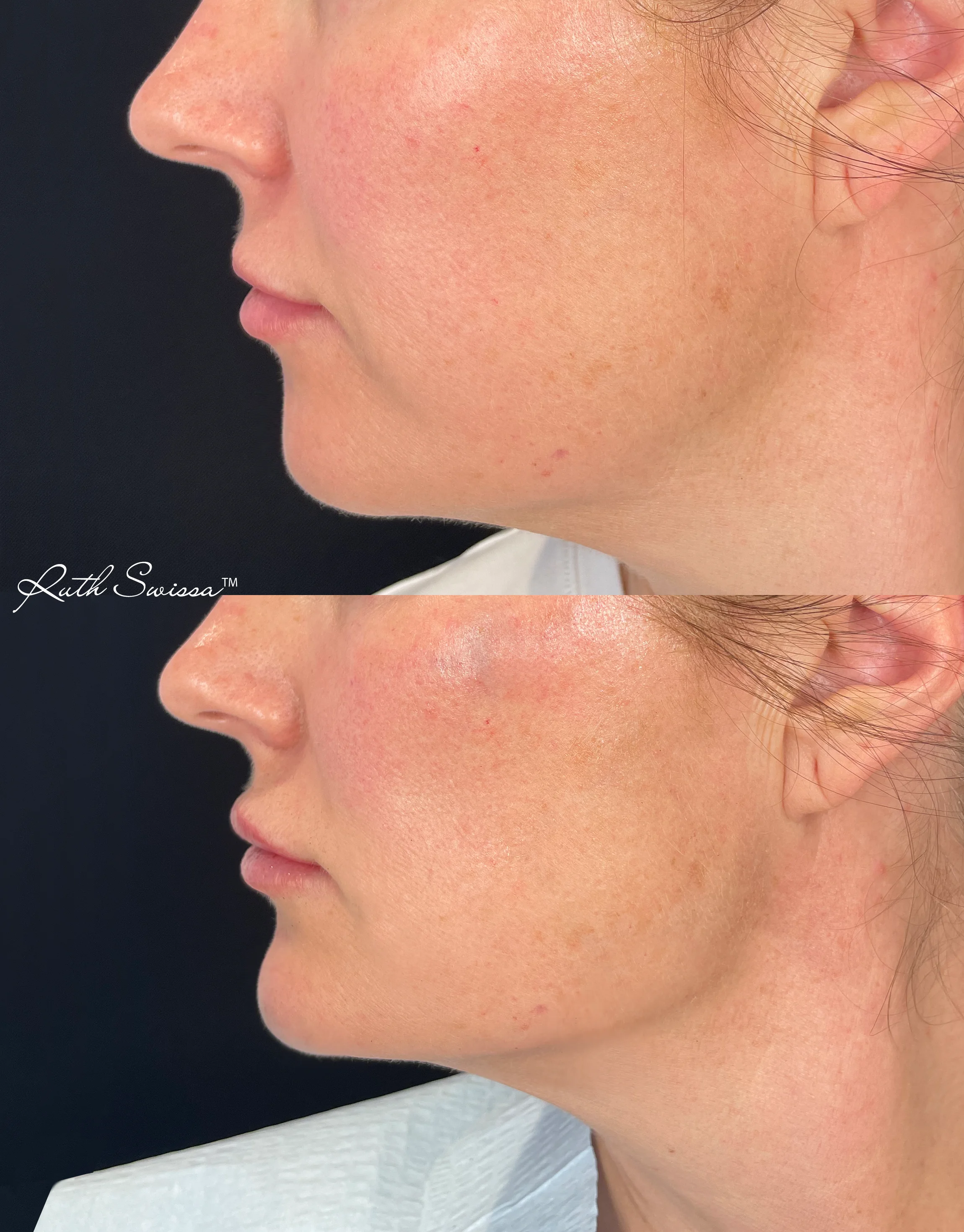Facial balancing