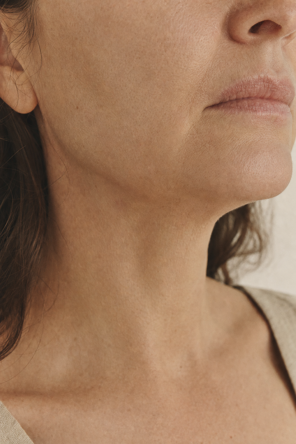 Aesthetic concern · lower face