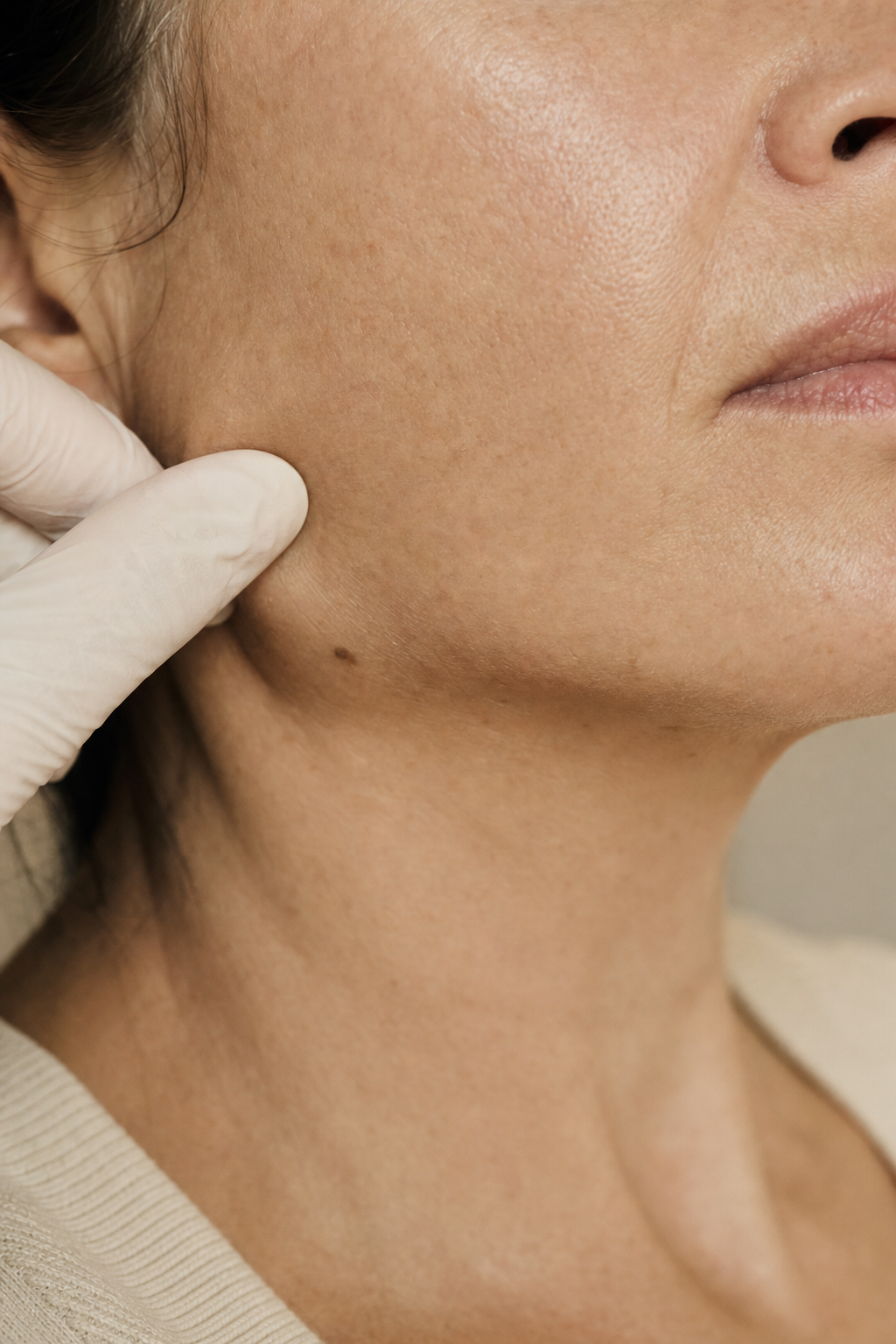 Jawline assessment · RF candidacy