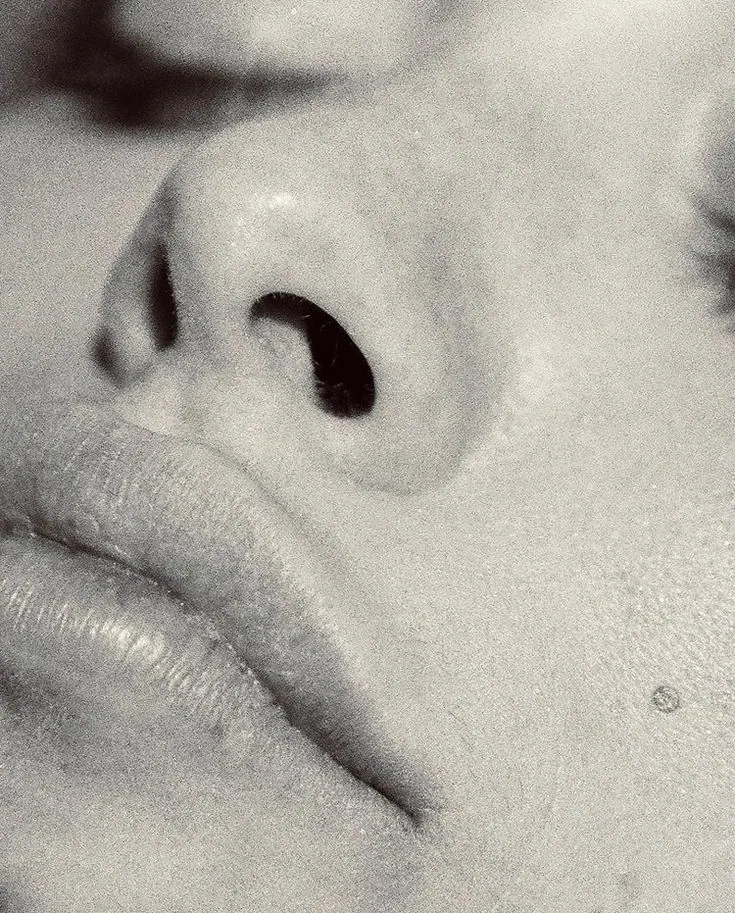 Morpheus8 vs microneedling vs RF microneedling. What's the difference?